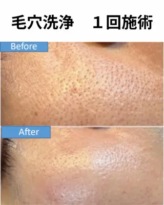 グリーニャ セルフエステのその他イメージ
