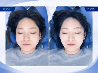 ❇️美容カイロ整体/ 美姿勢/肩凝り/腰痛のエステ・リラクイメージ