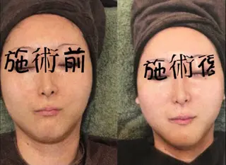 毛穴、小顔専門店 サロンドシェリーのエステ・リラクイメージ