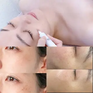 LiZA エステティックサロンのエステ・リラクイメージ