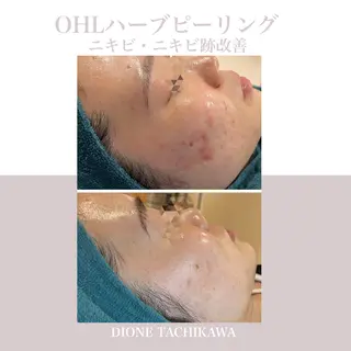 Dione 立川店のエステ・リラクイメージ