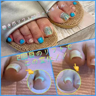 ネイル ♢ME2ROOM♢ #巻き爪#リラクのネイルデザイン