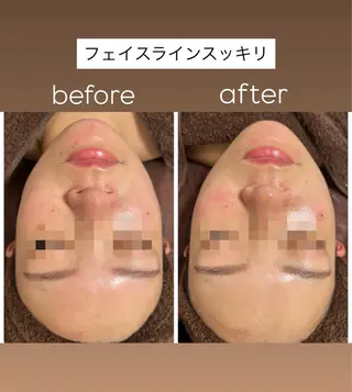 産毛角質ケア/艶肌 フェイシャルワックスのエステ・リラクイメージ