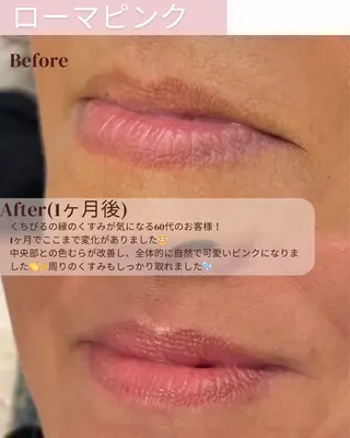 【ローマピンク施術】 Kaoのその他イメージ