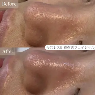 LUCOL￤池袋西口 ￤肌質改善￤EMIのエステ・リラクイメージ
