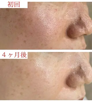 茨城土浦 つくば毛穴 ケア専門サロンのエステ・リラクイメージ