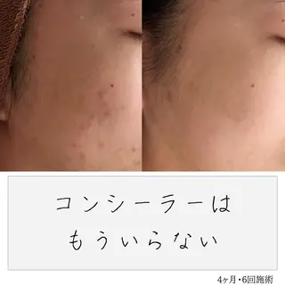 ニキビ経験者が施術 する専門サロン🌻のエステ・リラクイメージ
