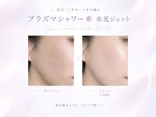マツエク・マツパ 愛維美水光美肌専門店 メンズレディースokのエステ・リラクイメージ