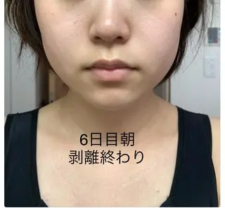 🫧エステティック RAYVISなかやのエステ・リラクイメージ