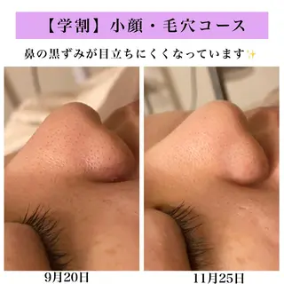 Bellesthe (ベルエステ)のエステ・リラクイメージ