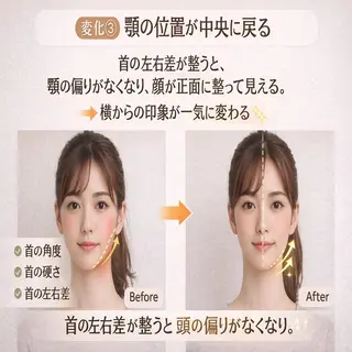 小顔&美肌 サロンLINKAのエステ・リラクイメージ