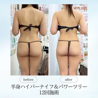 《痩身、小顔専門店》 エスプレッソのエステ・リラクイメージ