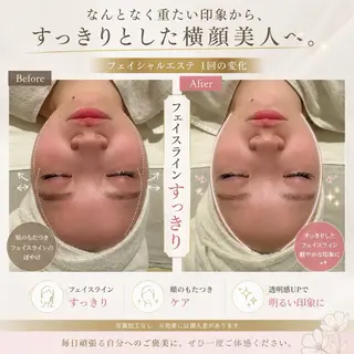 肌管理🌿毛穴改善 POLA堺東のエステ・リラクイメージ