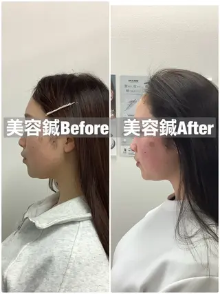 ハリサロンドオフ 美容鍼灸×小顔整体のエステ・リラクイメージ