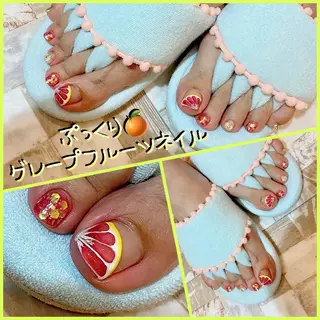 ネイル ♢ME2ROOM♢ #巻き爪#リラクのネイルデザイン
