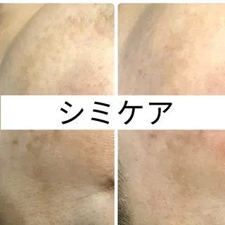 ハーブピーリング LINON(リノン)のエステ・リラクイメージ