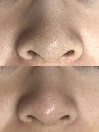 THEBALM神楽坂 【店長】はるな🎀のマツエク・マツパデザイン