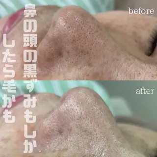mish eyebrowのエステ・リラクイメージ