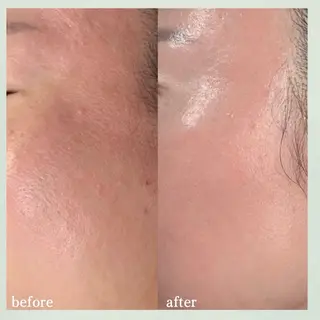 看護師 AYUIのエステ・リラクイメージ