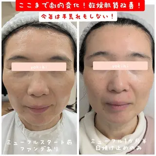 結果が出るスキンケア 肌質改善/まつパのエステ・リラクイメージ