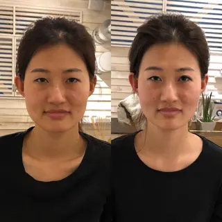 恵比寿/代官山 鍼灸師/根本亮佑のエステ・リラクイメージ