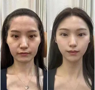 マツエク・マツパ 愛維美水光専門店 川崎彩鳳のエステ・リラクイメージ