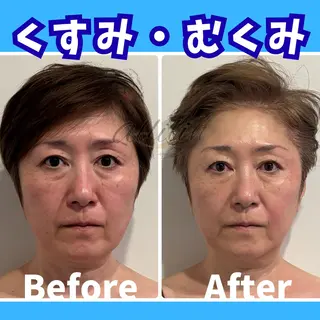 💎小顔ｻﾛﾝ アリリン銀座💎のエステ・リラクイメージ