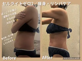 Arisa｜阪神西宮 肩こり腰痛リンパ痩身のエステ・リラクイメージ