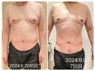 小顔&まつ毛サロン AKANE❤️のマツエク・マツパデザイン