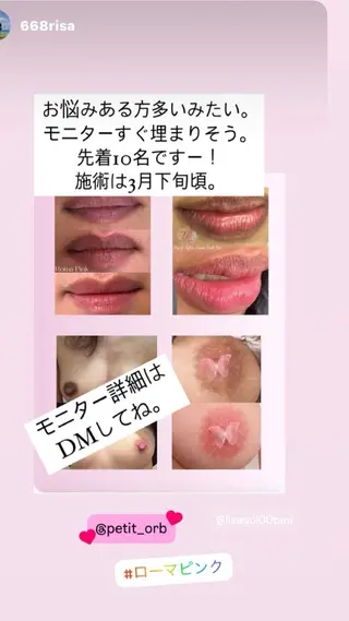 肌改善グリーンピール 東川口/浦和美園のエステ・リラクイメージ