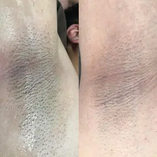 脱毛サロン Plageプラージュのエステ・リラクイメージ