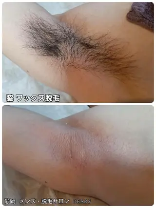 メンズ 山村幸久 メンズ脱毛 ディアーズのエステ・リラクイメージ