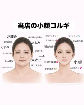 韓国小顔コルギ ・リフトアップ専門のエステ・リラクイメージ