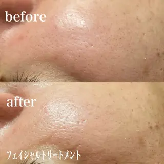 磐田|LAYLA 一番丁寧な脱毛店のエステ・リラクイメージ