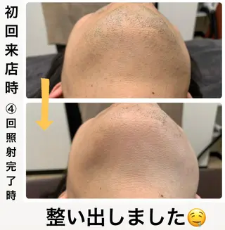 メンズ脱毛サロン Le falcoのエステ・リラクイメージ