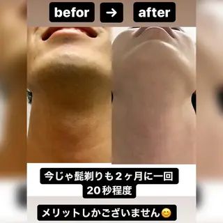メンズ メンズ脱毛サロン ／金山昌弘のエステ・リラクイメージ