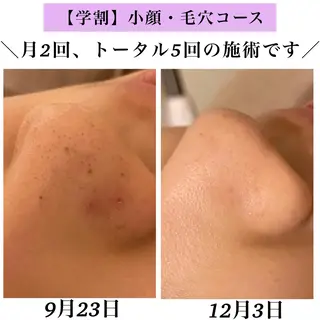 Bellesthe (ベルエステ)のエステ・リラクイメージ