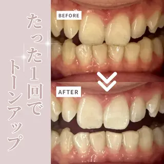 LIBRA自由が丘 ホワイトニングのその他イメージ