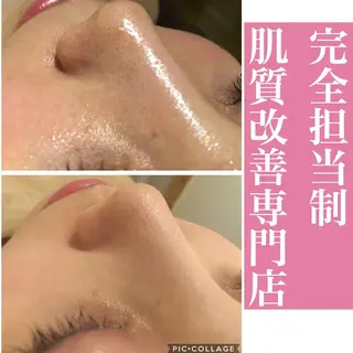 ミディアム カラー パーマ ヘアアレンジ メンズ キッズ ネイル マツエク・マツパ アイブロウ ニキビ・肌質改善専門 ♡人生が変わるサロンのエステ・リラクイメージ