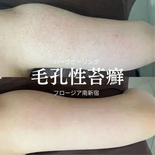 MI SUZUのエステ・リラクイメージ