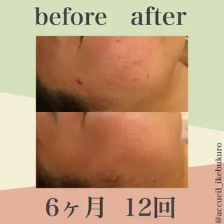 ミディアム カラー パーマ ヘアアレンジ メンズ キッズ ネイル マツエク・マツパ ニキビ・肌質改善専門 ♡人生が変わるサロンのエステ・リラクイメージ