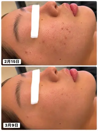 透明感color💛 艶髪矯正✂️大石のエステ・リラクイメージ