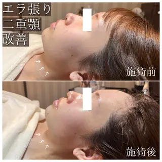 La Dusa 韓国肌管理/小波のエステ・リラクイメージ