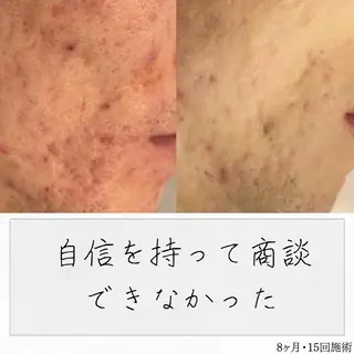 ニキビ経験者が施術 する専門サロン🌻のエステ・リラクイメージ