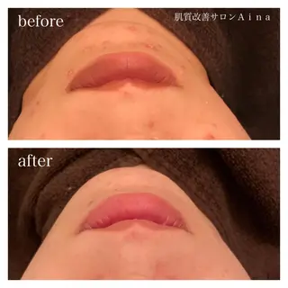セミロング パーマ ヘアアレンジ キッズ ネイル マツエク・マツパ ニキビ跡専門サロン Ａｉｎａのエステ・リラクイメージ