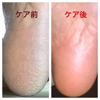 ショート ネイル 🌱 ま し お 🌱のエステ・リラクイメージ