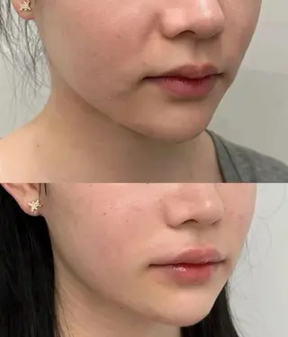 ネイル 愛維美水光専門店 川崎彩鳳のエステ・リラクイメージ