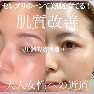 GRANVIR グランヴィールのエステ・リラクイメージ