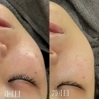 艶肌デトックス🫧 Samiraのエステ・リラクイメージ