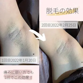 都度払い脱毛サロン LEPIA服部 内田のエステ・リラクイメージ